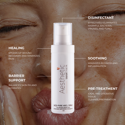 Smart Aesthetic Medi Pure Hocl Spray